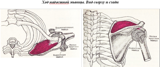 a vállízület supraspinatus izomjának inakárosodása