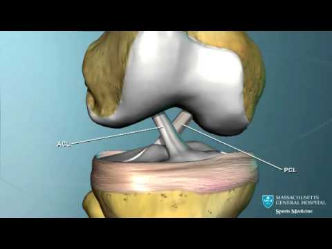 Térd - Súlypont Ízületklinika