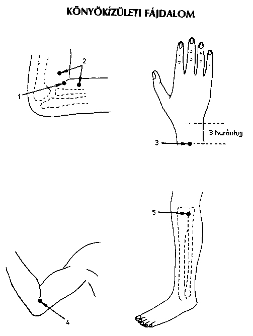 miért fáj a könyökízületek