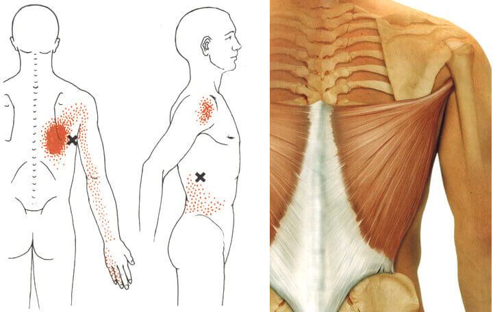 a deformáló artrózis homeopátia kezelése