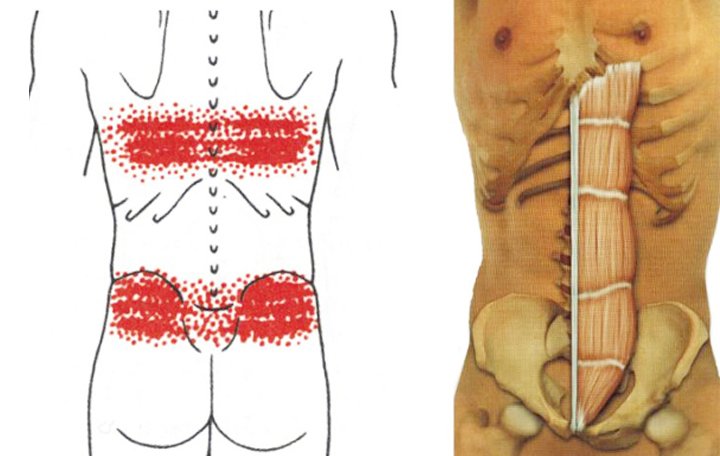 kenőcs a gerinc osteokondrozisához ízületi gyulladás bárányban