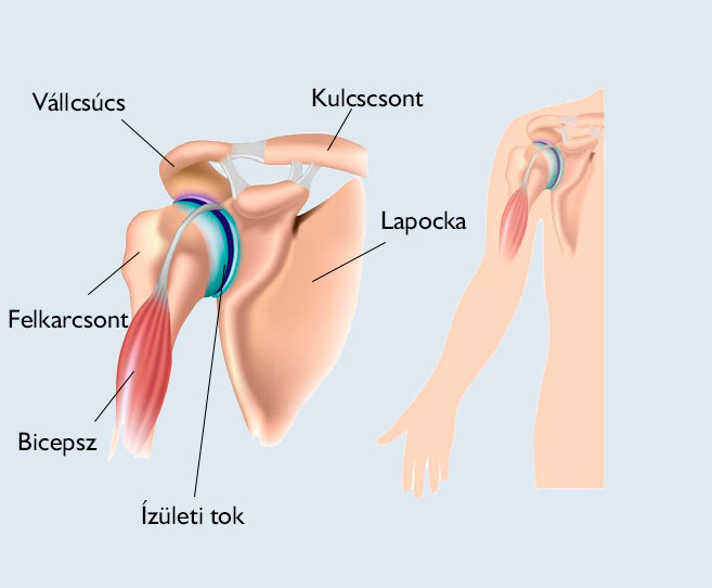 Plázs: Erős paprika – az okos fájdalomcsillapító | www.schweidelszallo.hu