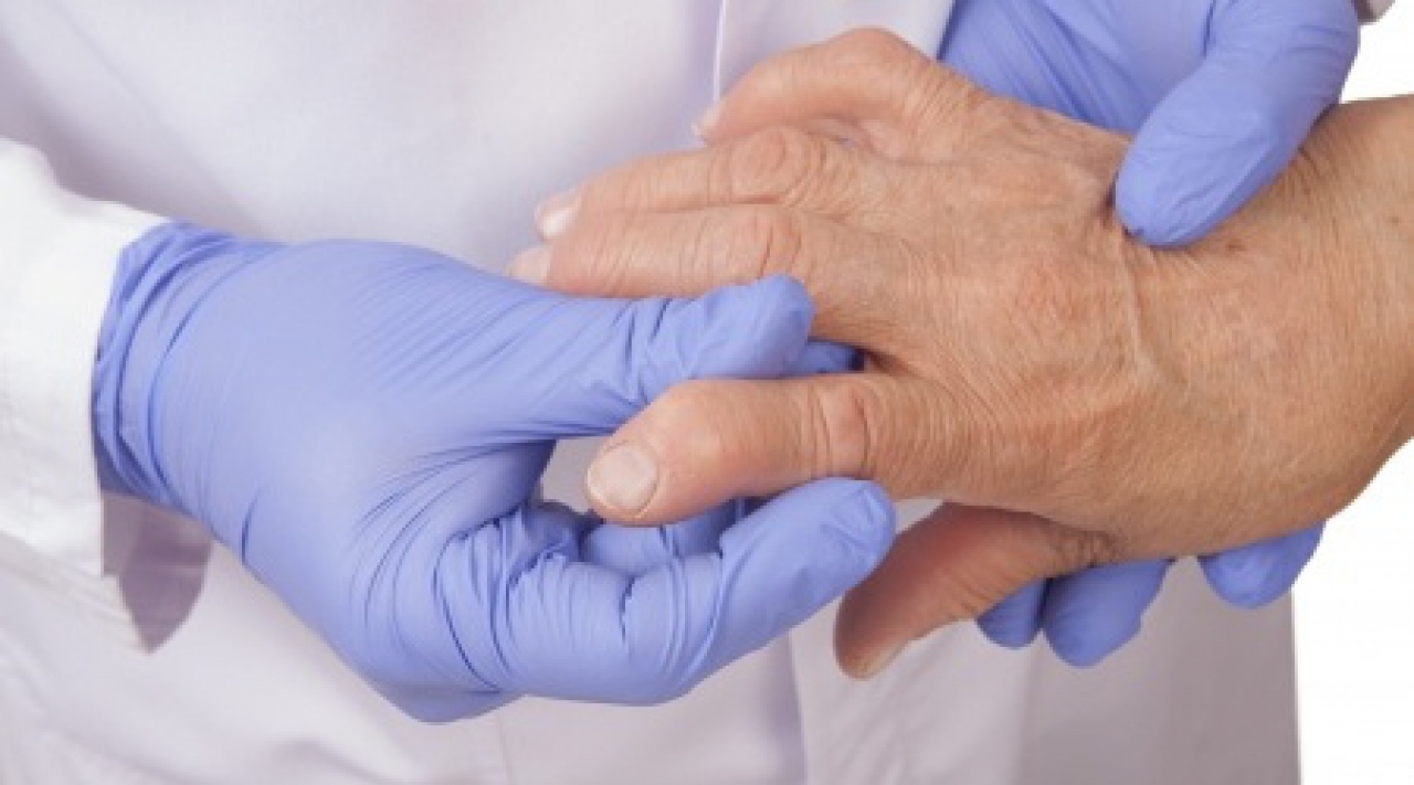 Ízületi gyulladás 3 oka, 4 tünete, 9 kezelési módja [teljes útmutató]